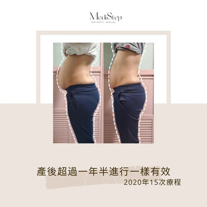 AeStep 獨家『九步束腹術』